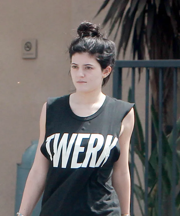 FOTO: Transformasi Kylie Jenner Sebelum & Sesudah Operasi Plastik