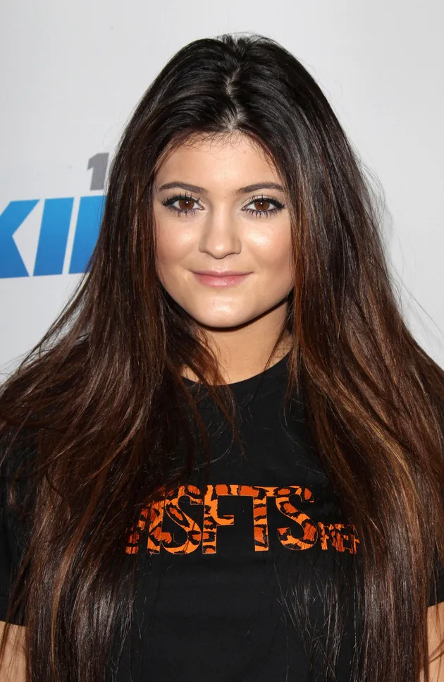 FOTO: TRANSFORMASI KYLIE JENNER SEBELUM & SESUDAH OPERASI PLASTIK