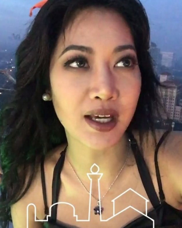 FOTO: TRANSFORMASI WAJAH WIDY VIERRATALE, HIDUNG MAKIN 
