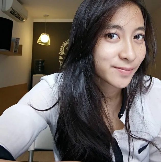 fisioterapis, windy mayang, fisioterapis cantik