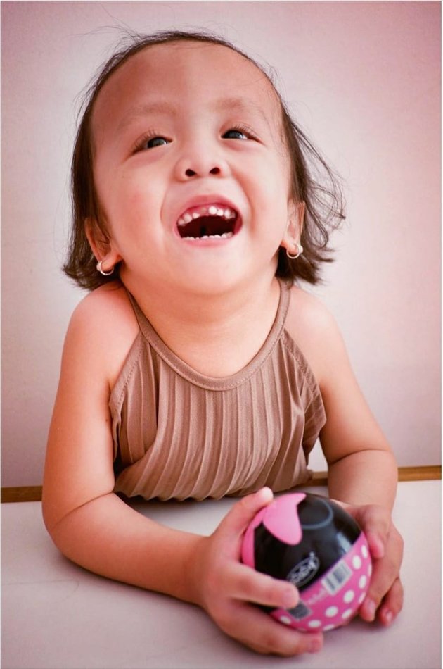 Photo of Zio Putri Bungsu Joanna Alexandra with Special Needs, Getting Smarter and Becoming the Family's Moodbooster