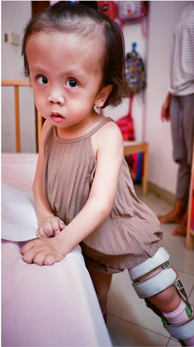 Photo of Zio Putri Bungsu Joanna Alexandra with Special Needs, Getting Smarter and Becoming the Family's Moodbooster