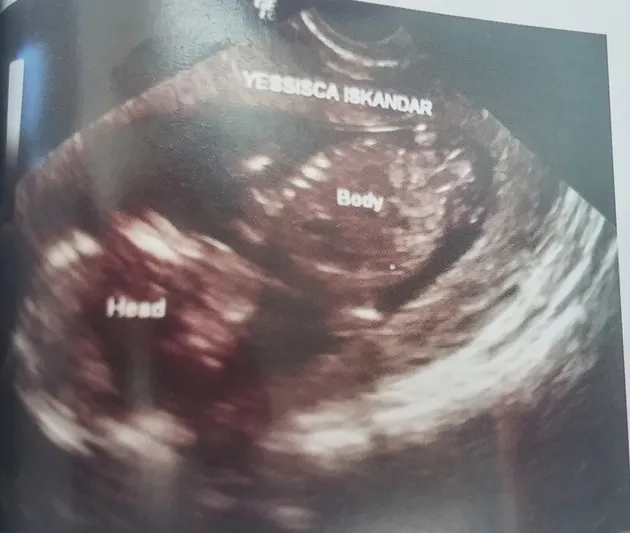 Putra Jessica Iskandar