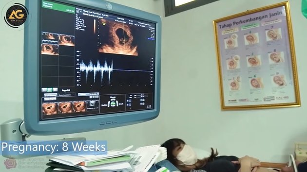 First Pregnancy After 4 Years of Waiting, Take a Look at Adiezty Fersa's First Ultrasound - 4 Months Pregnant