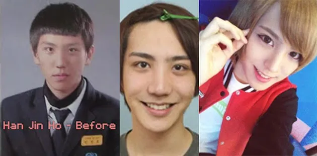 Han Jin Ho ulzzang oplas