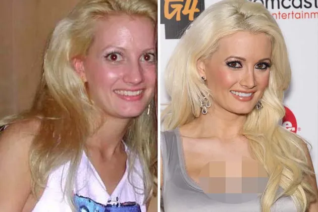 Holly Madison dilaporkan menghabiskan 8800 dolar atau sekitar 110 jutaan demi serangkaian operasi plastik yang dijalaninya, termasuk mengubah ukuran dadanya dari A ke D, hmm...