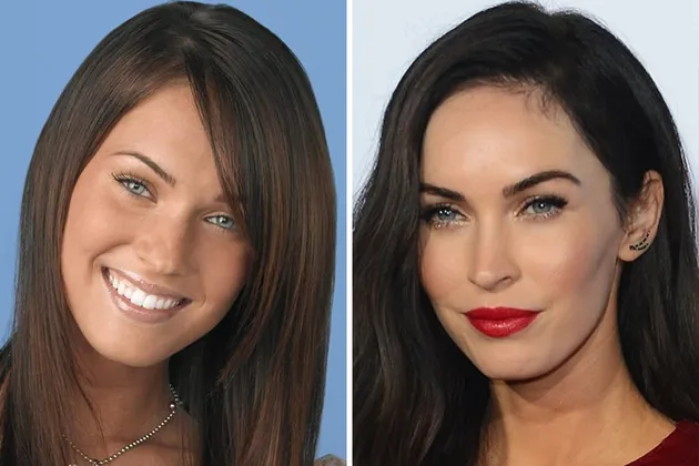 operasi plastik, harga operasi plastik, biaya operasi plastik selebriti