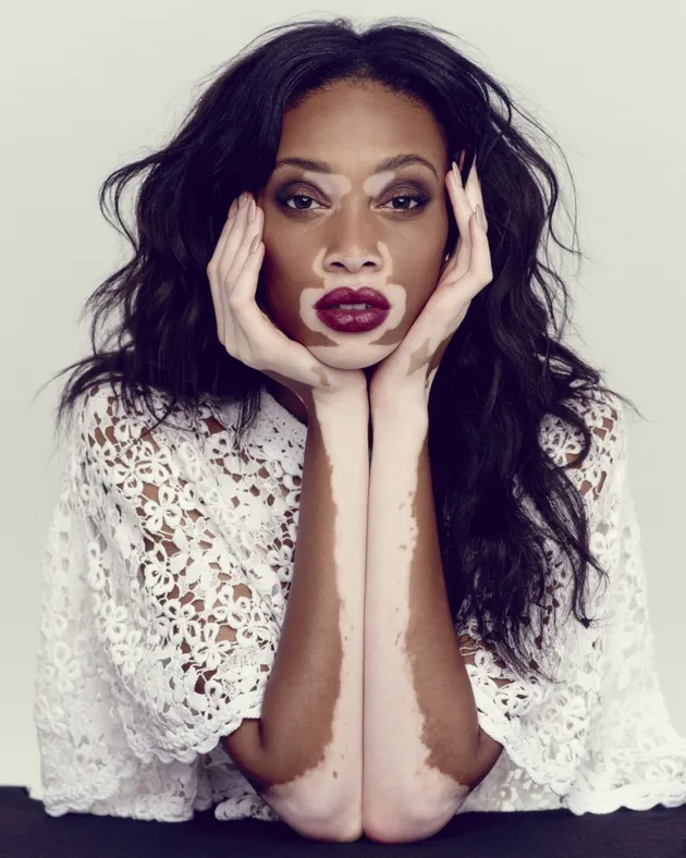 Chantelle Winnie