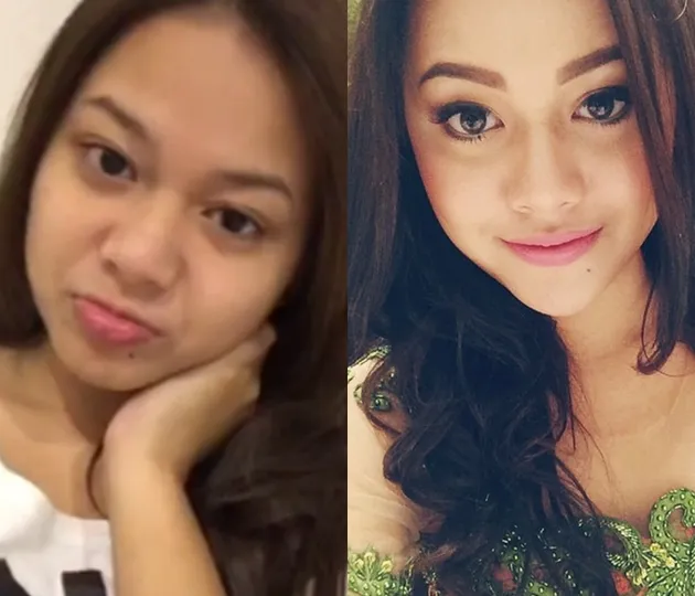 Aurel Hermansyah 