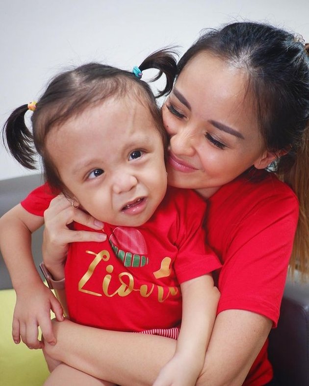 Being a Great Mother, Here are 9 Moments of Joanna Alexandra's Patience in Caring for Her Daughter with a Rare Genetic Disease