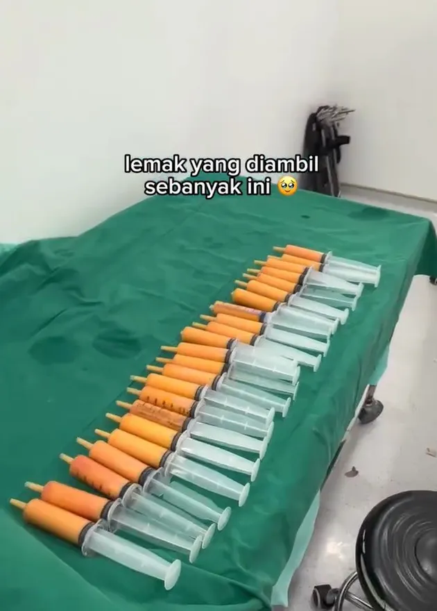 Lemak Jovita Karen yang Dikeluarkan dari Lengannya