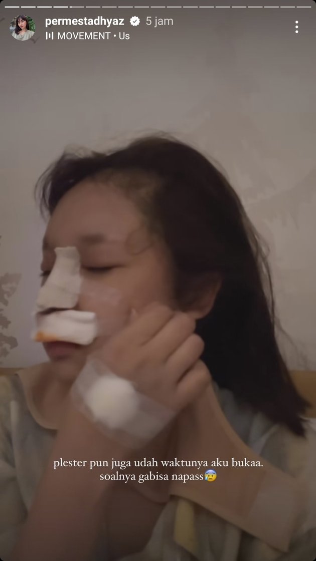 <nil>