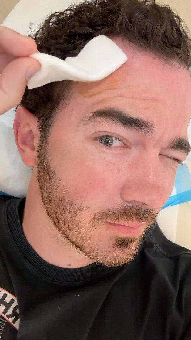 8 Portraits of Kevin Jonas Revealing Himself Undergoing Minor Surgery to Remove Skin Cancer from the Front of His Head