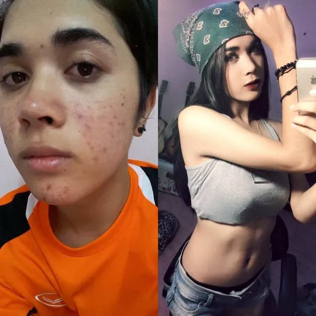 Transformasi Transgender