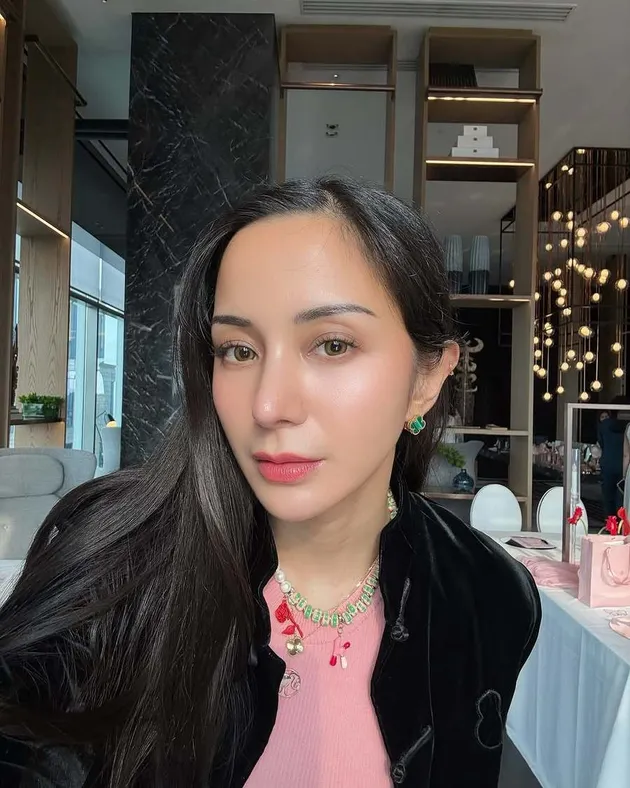 Alasan Kirana Larasati Operasi Hidung