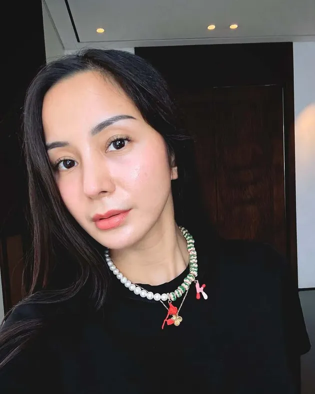 Alasan Kirana Larasati Operasi Hidung