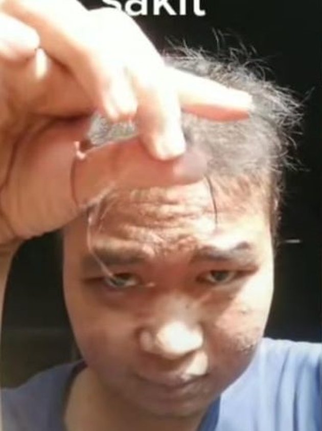 <nil>