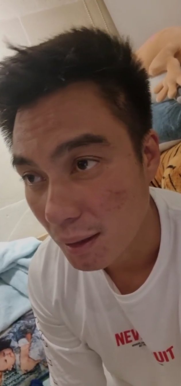 <nil>