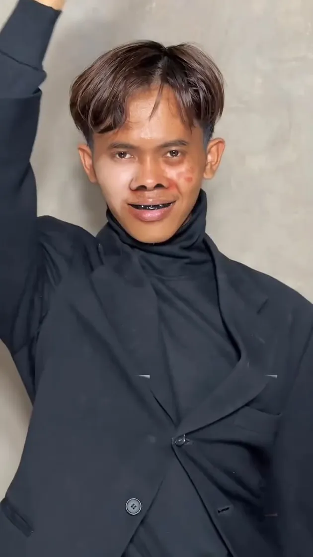 <nil>