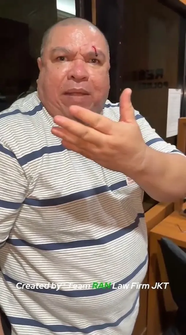 Lolly Dapat Pendampingan Kejiwaan di RS Polri