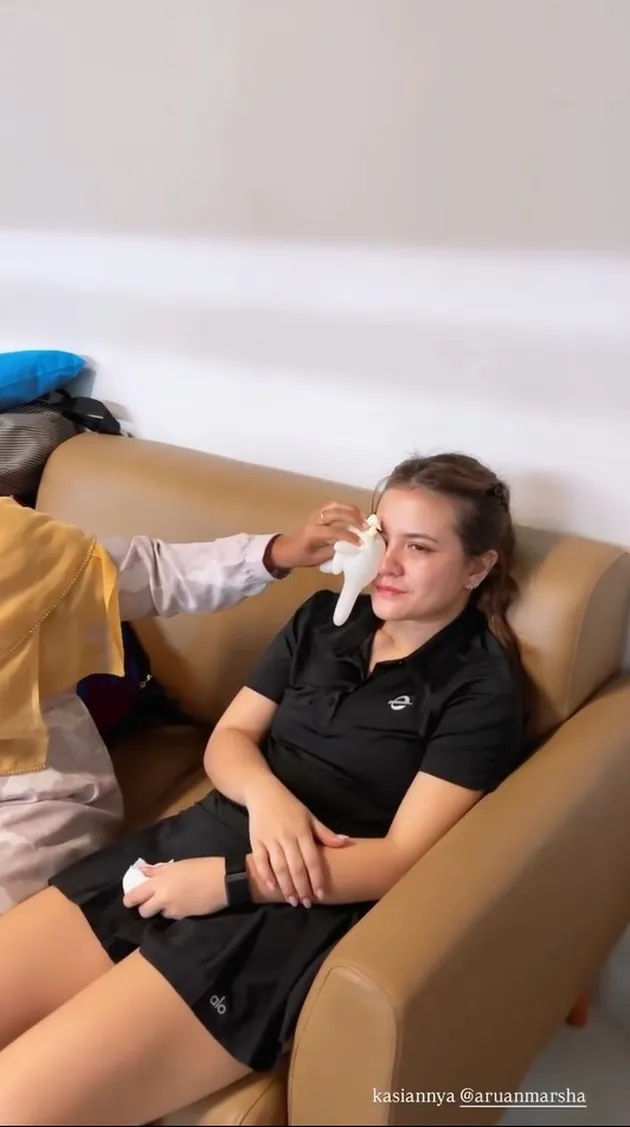 Kondisi Mata Marsha Aruan