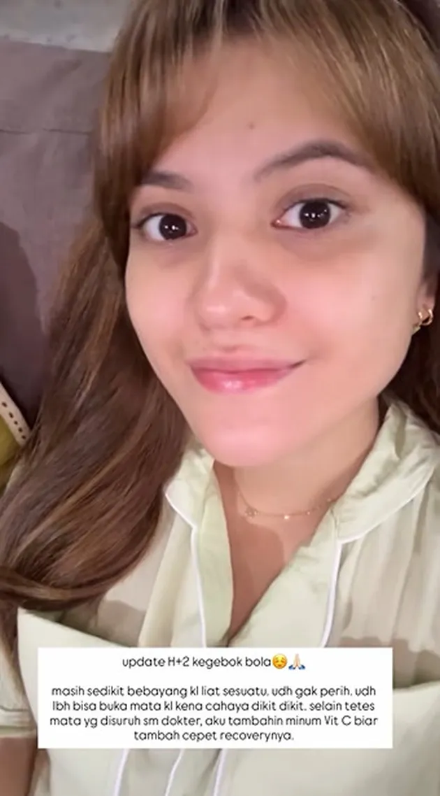 Kondisi Mata Marsha Aruan