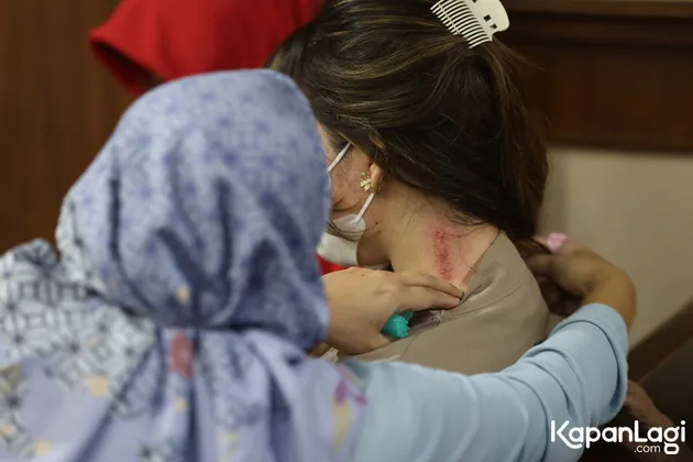 Dokter Kamelia Kerokan di Sidang Ammar Zoni 