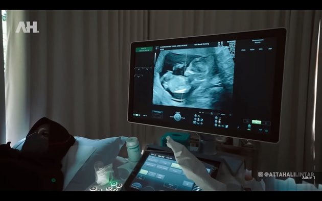Momen 4D USG, Atta sangat gemas melihat bayi yang dikandung sang istri di layar kaca televisi.