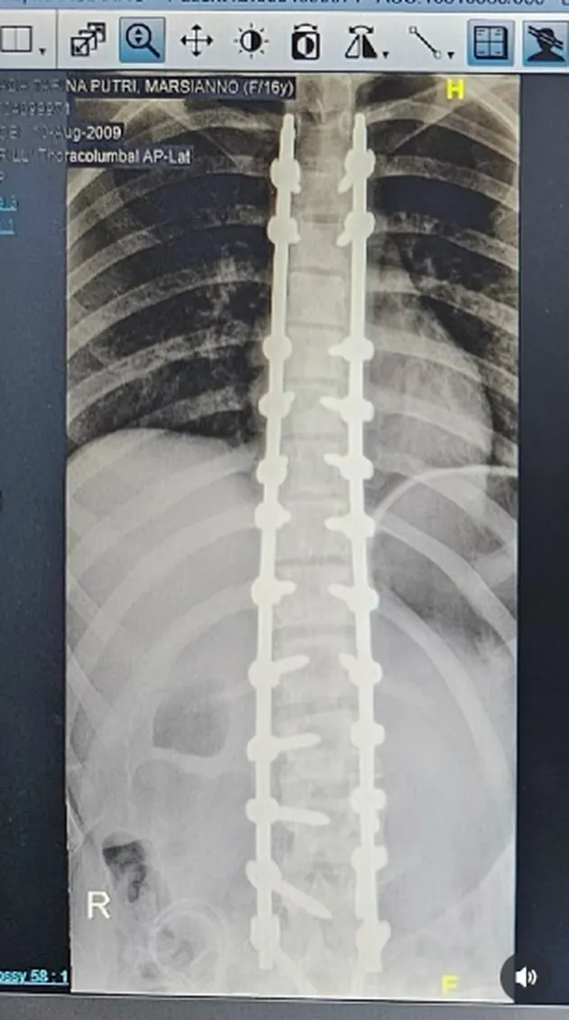 <nil>