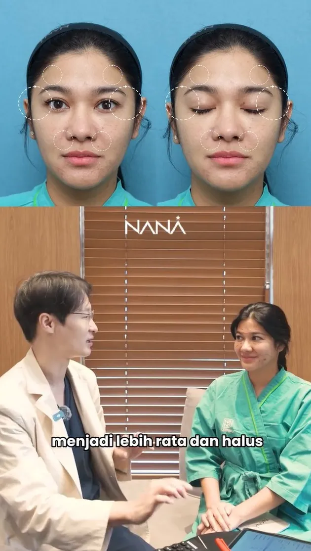 <nil>