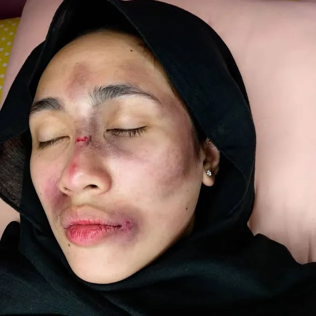 berita young lex, kabar young lex, kontroversi young lex