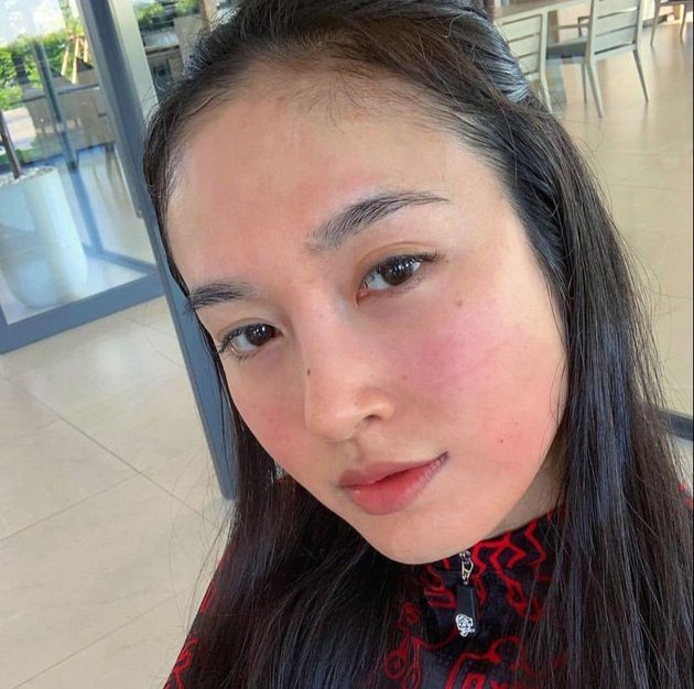 Admitting To Never Having Facial Plastic Surgery 10 Photos Of Nong Poy