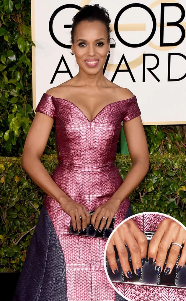 Golden Globe 2015