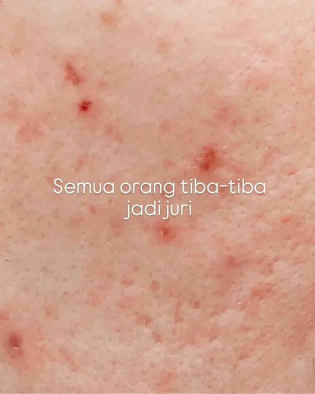 Unggah foto close up kulit