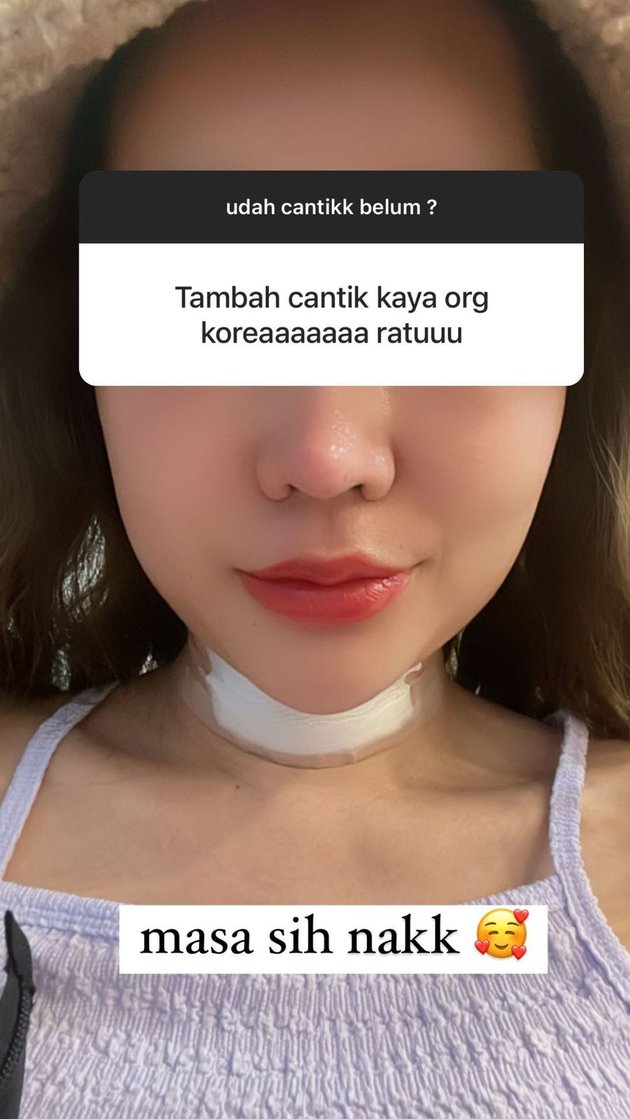 <nil>