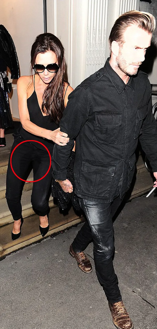 Victoria Beckham \&#039;Ngompol\&#039; di Depan Umum