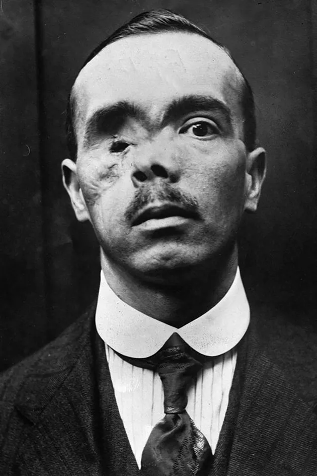 Potret Perang Dunia Ke-2