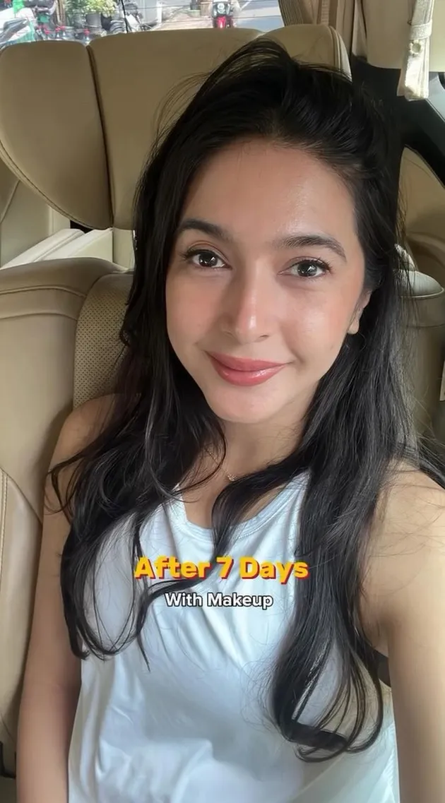 Nabila Syakieb Lakukan Perawatan Wajah di Korea