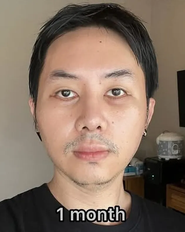 <nil>