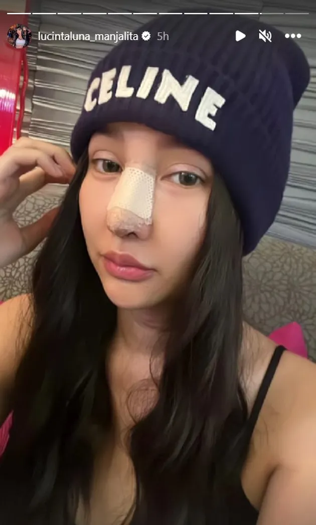 <nil>