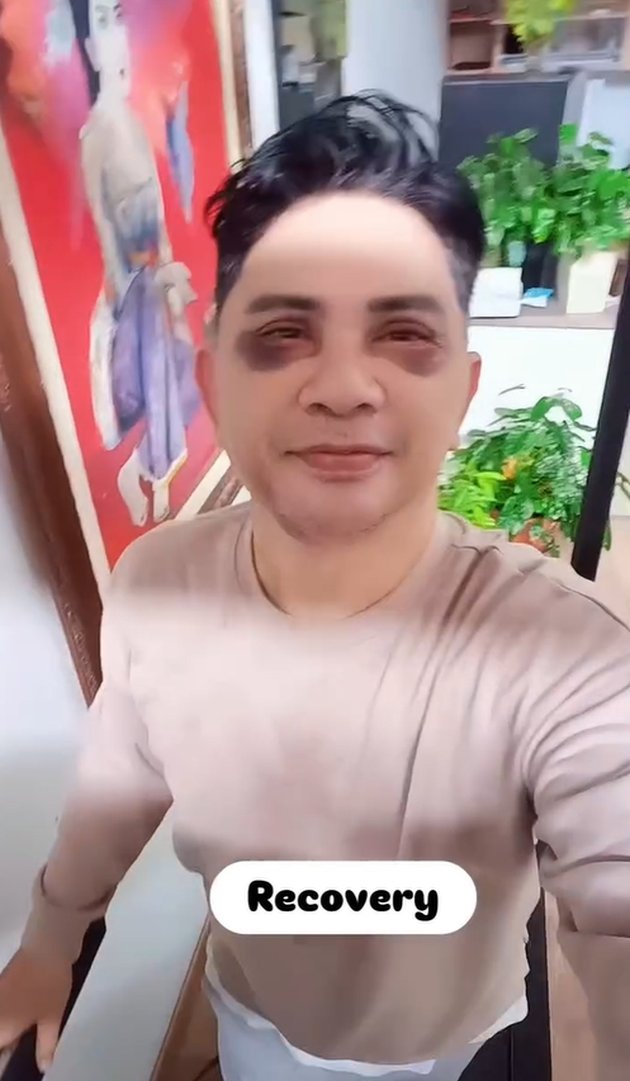 <nil>