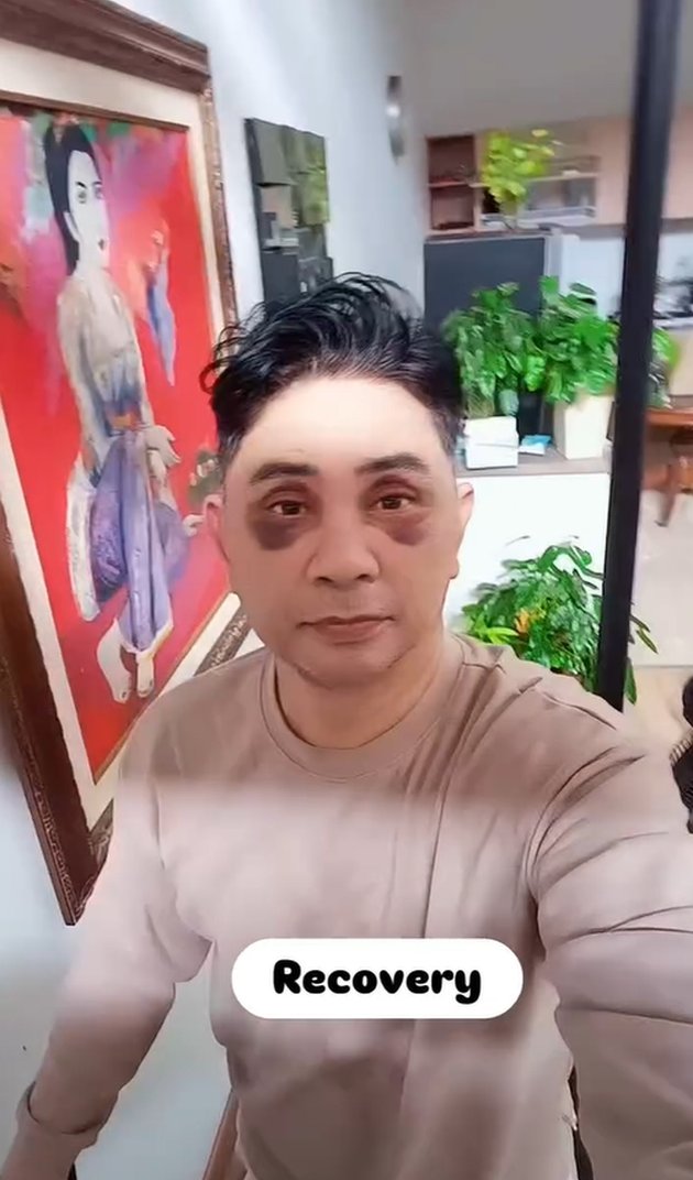 <nil>