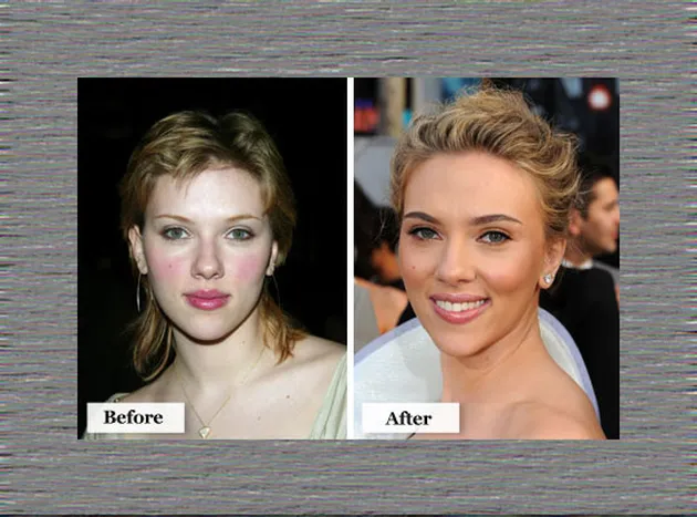 Artis Hollywood