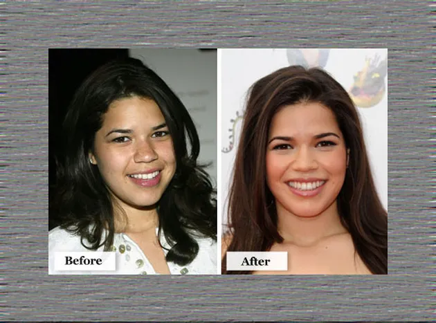 Artis Hollywood