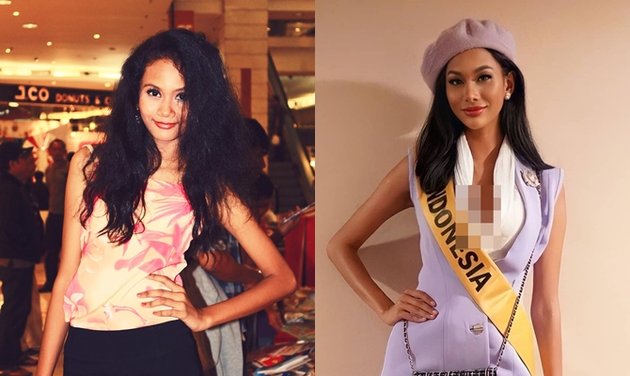Criticism for Plastic Surgery, Here are 8 Photos of Aurra Kharishma Before and After That are Very Different - Ivan Gunawan: Not Endorsing Plastic Surgery!