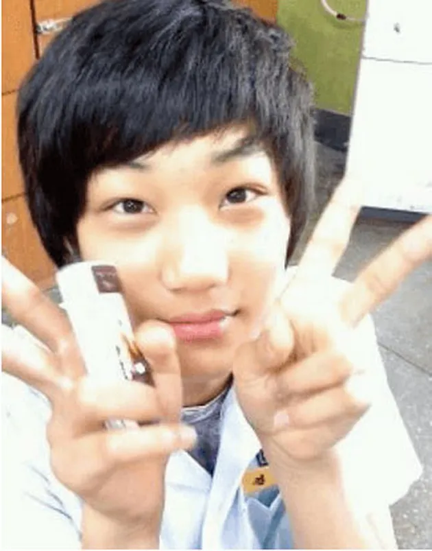 SEDERET BUKTI JIKA KETAMPANAN EXO HASIL OPLAS? SEGERA ...