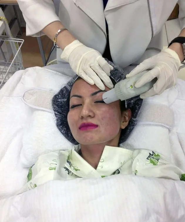 selebriti yang tanam benang, treatment tanam benang