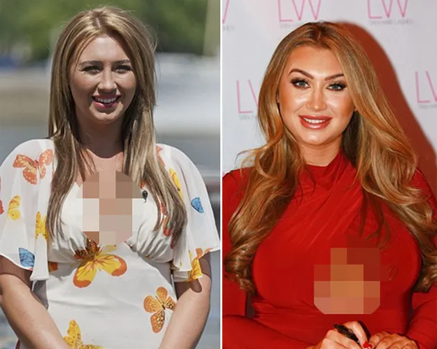 Artis Hollywood Operasi Plastik