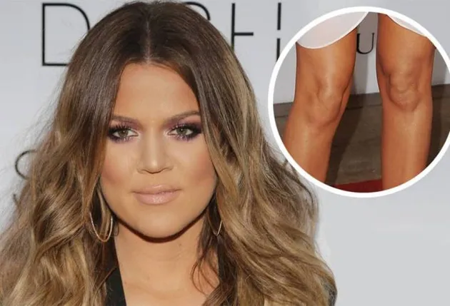 Artis Yang Jalani Operasi