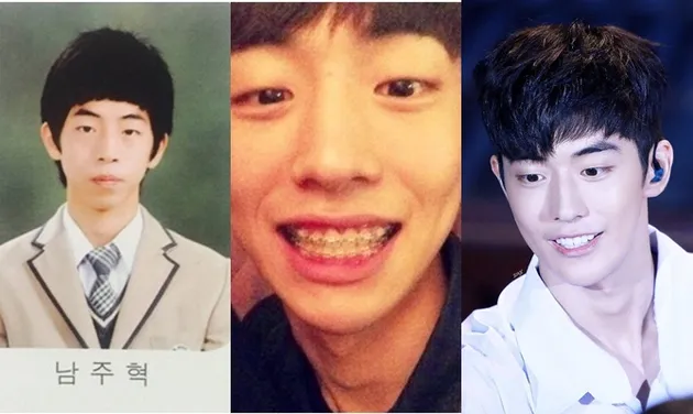 seleb korea memperbaiki gigi